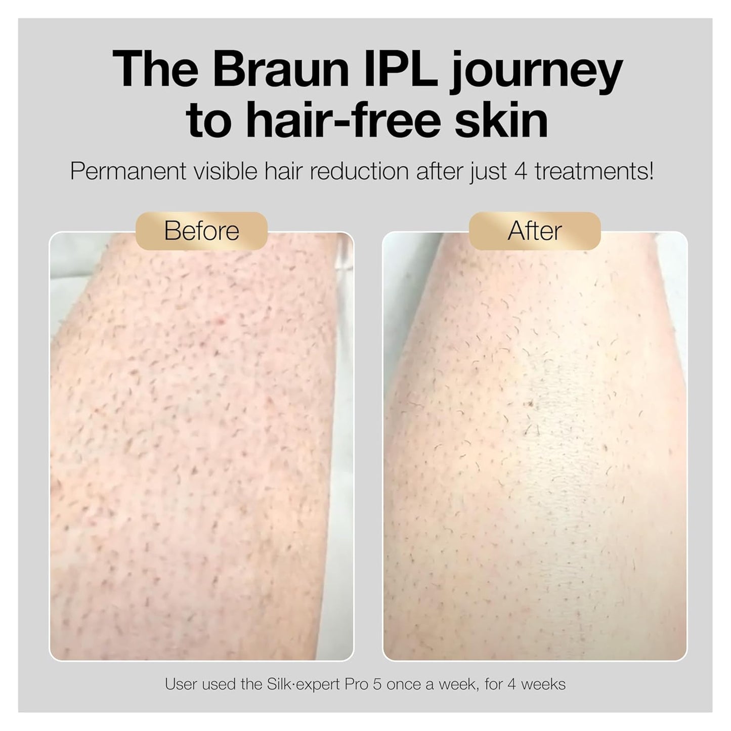 IPL Silk·Expert Pro 5 PL5347 Latest Generation IPL for Women and Men, At-Home Hair Removal System, Salon-Like Smooth Skin, Long Lasting Results, 3 Comfort Modes W/Wide Head & 2 Precision Heads