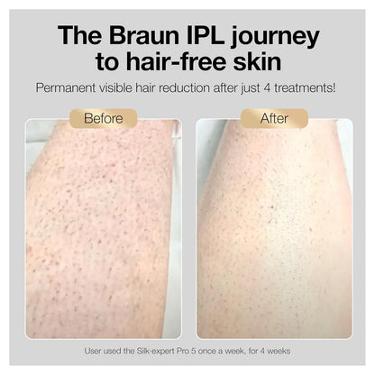 IPL Silk·Expert Pro 5 PL5347 Latest Generation IPL for Women and Men, At-Home Hair Removal System, Salon-Like Smooth Skin, Long Lasting Results, 3 Comfort Modes W/Wide Head & 2 Precision Heads