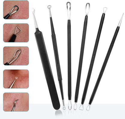 Blackhead Remover Pimple Popper Tool Kit - (6 Piece Kit) - Professional Stainless Pimples Comedone Extractor Removal Tool